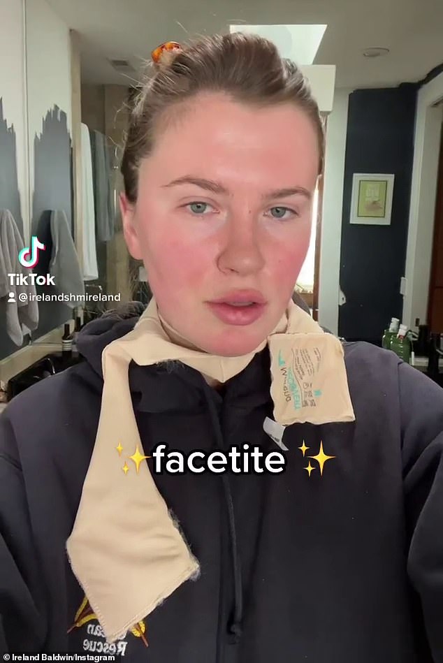 Ireland Baldwin erklärt, warum sie sich im Alter von 26 Jahren einem „Mini-Facelifting“ unterziehen musste